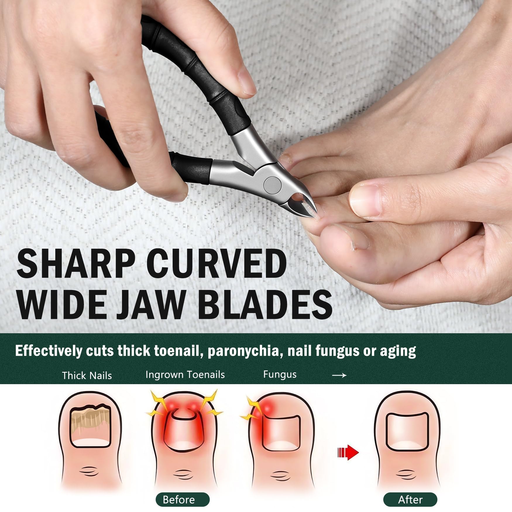 FVION Coupe-ongles Epais Pied à mâchoires Larges Ouvertes, Pince Ongles Incarne Pieds Antidérapant à Long Manche pour Personnes âgées, Ciseaux a Ongles Pieds de Précision (Noir)