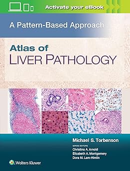 ATLAS OF LIVER PATHOLOGY A PATTERN BASED APPROACH (HB 2020)