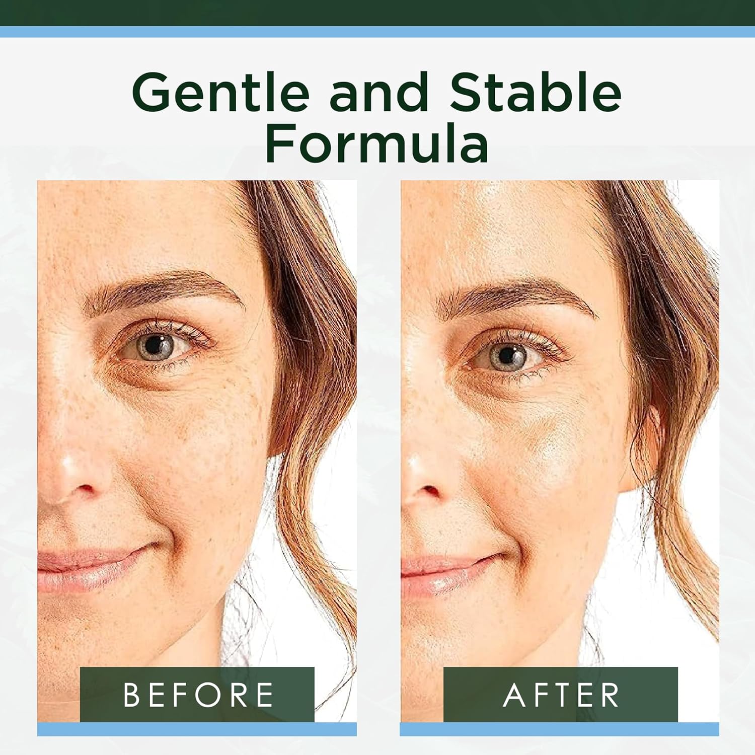 Tree of Life Hyaluronic Acid Serum, 2 Fl Oz (Pack of 4)