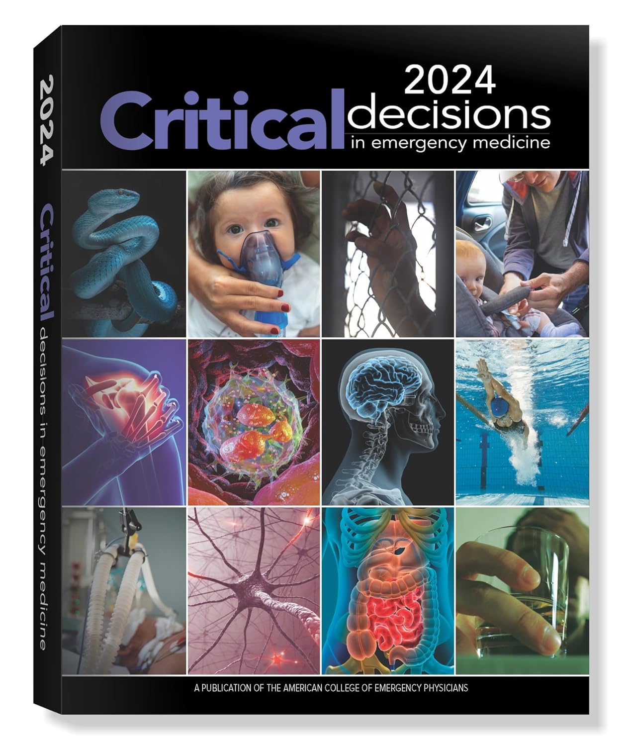 2024 Critical Decisions in Emergency Medicine: A Publication of the American College of Emergency Medicine      Paperback – November 1, 2025