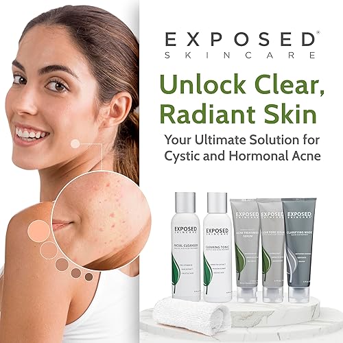 Miniatura 9 de Exposed Skin Care Kit de tratamiento para el acné incluye limpiador facial tónico limpiador suero para tratamiento del acné suero de poros