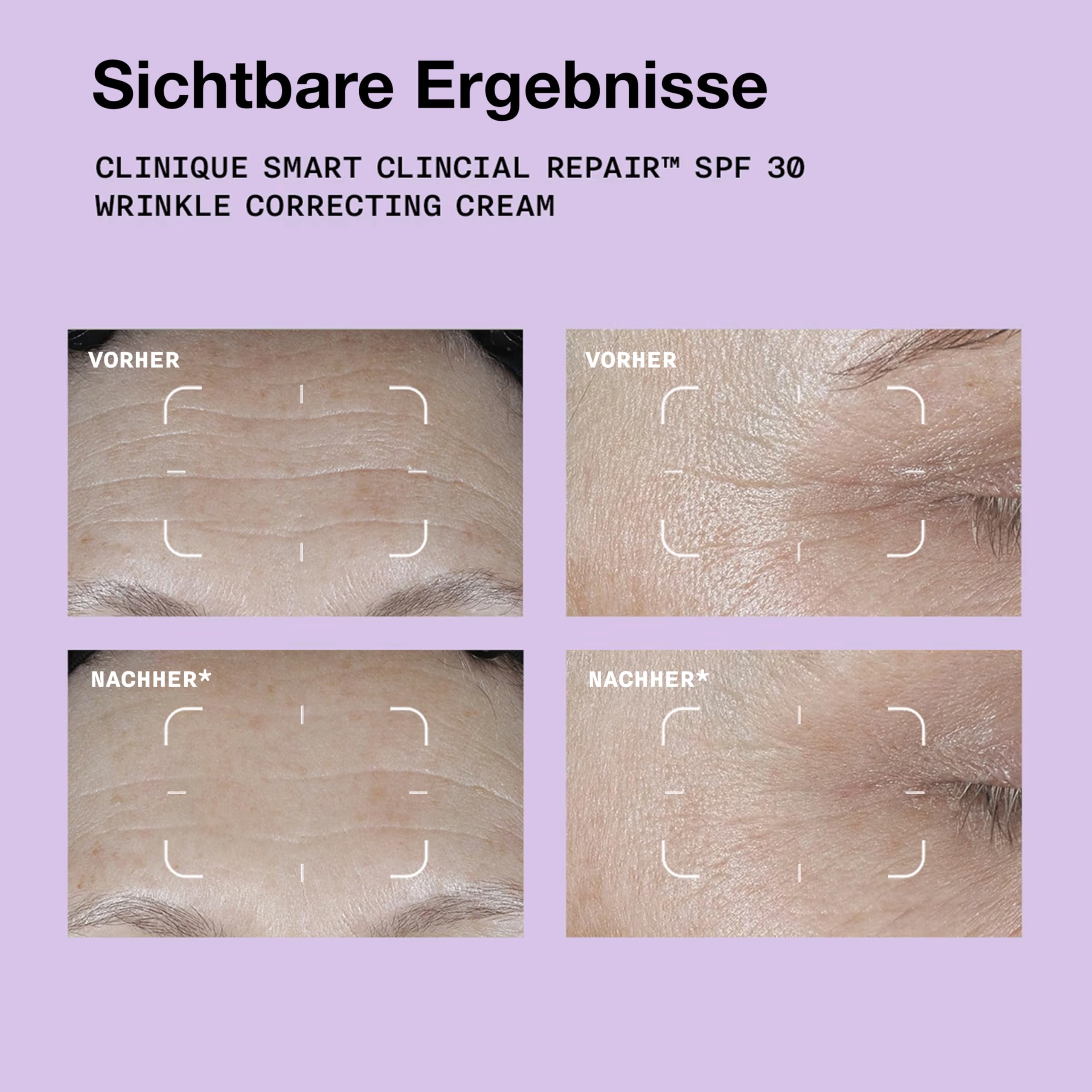 Smart Clinical Repair™ SPF 30 Wrinkle Correcting Cream | Mit Peptiden, Hyaluronsäure + Provitamin D | Schützt + regeneriert das Hautbild