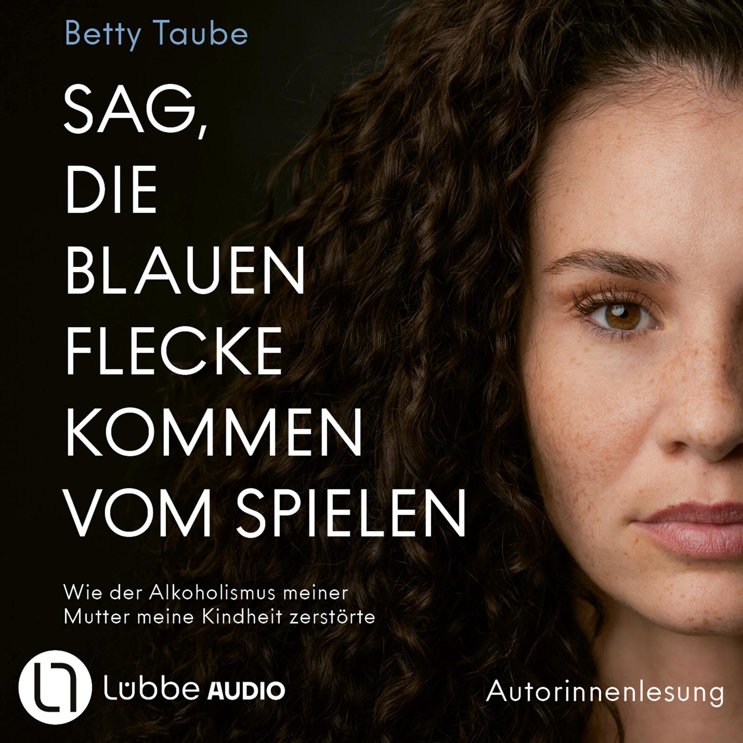 Cover art for Sag, die blauen Flecke kommen vom Spielen