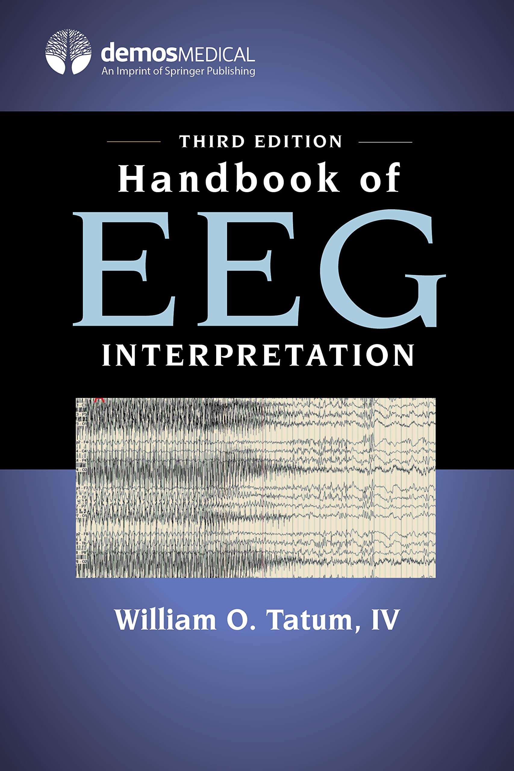 Handbook of Eeg Interpretation