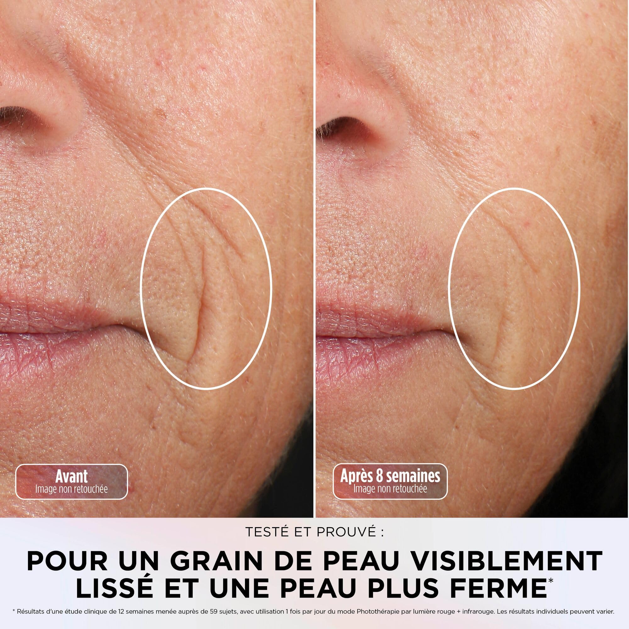 Masque LED Shark CryoGlow avec rafraîchissement du contour des yeux, LED rouge et bleue, Photothérapie par lumière infrarouge, USB-C, Télécommande + Stand de recharge du masque - Lilas XSKACS300EUPL