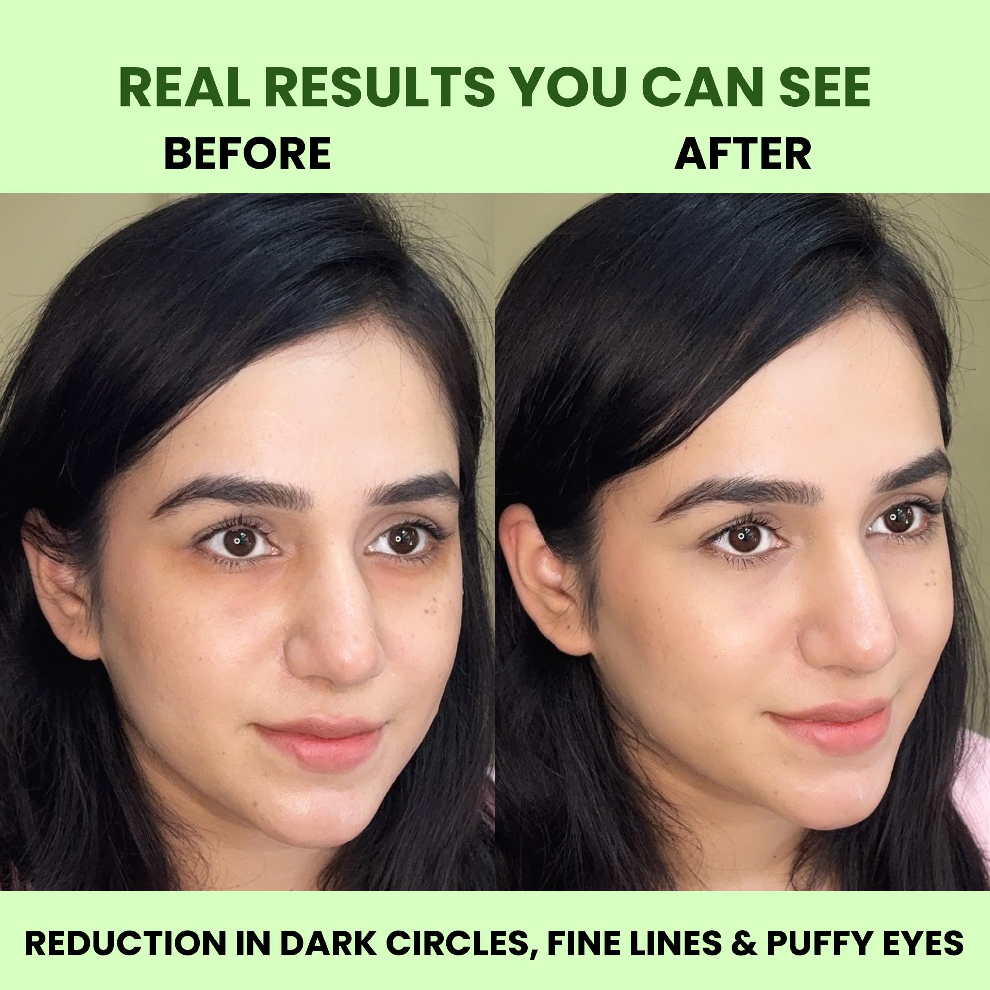 Carbamide Forte Hydrogel Under Eye Patches For Dark Circles | Under Eye Mask with Caffeine, Hyaluronic Acid, Aloe Vera & Snail Mucin | Reduces Dark Circles, Puffiness & Fine Lines | Eye Care Routine | Cooling, Hydrating & Repairing Eye Patches | 60 Patches (30 Pairs) for Men & Women - Image 7 thumbnail