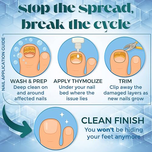 Miniatura 5 de Thymolize - Reparación de uñas dañadas  Cuidado del tratamiento de uñas encarnadas gruesas  Blanqueador de uñas para uñas amarillas y mordeduras de