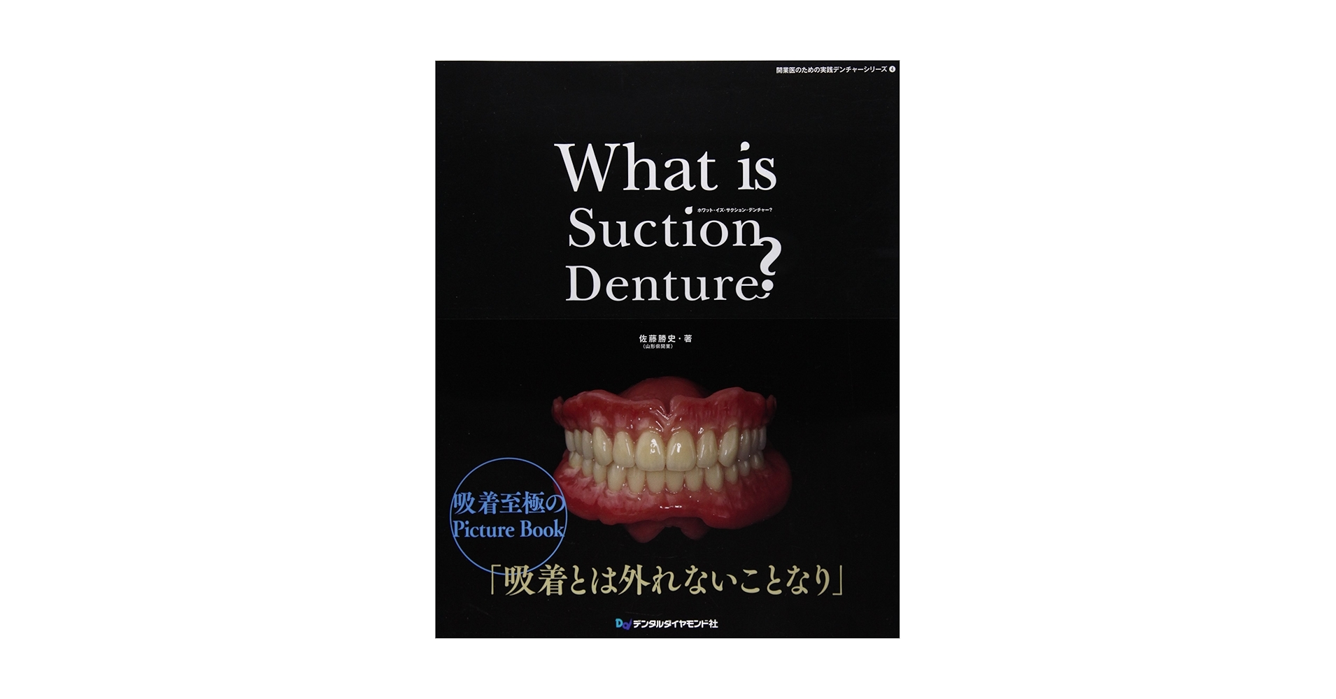 Amazon.co.jp: What is Suction Denture? (開業医のための実践