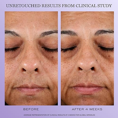 Miniatura 3 de Lancôme Rénergie H.P.N 300-Peptide Crema Facial - Con ácido hialurónico y niacinamida - Ayuda a reducir visiblemente la flacidez, las arrugas y las