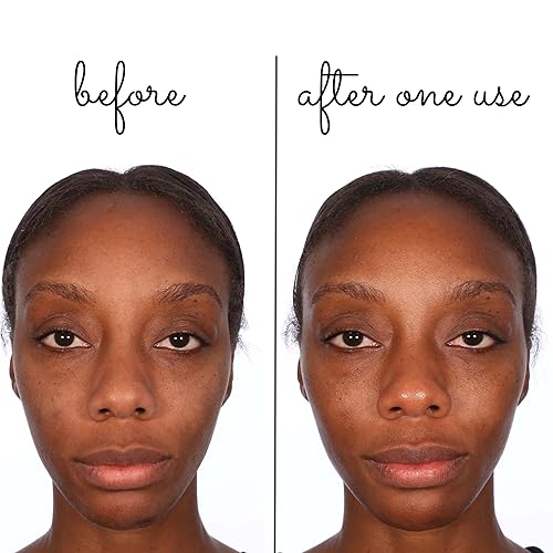 Miniatura 6 de Consult Beaute Volumagen Miracle Plumping Barrier Balm  Absorción de humedad facial  Hidratación de la piel profunda durante la noche  Piel seca