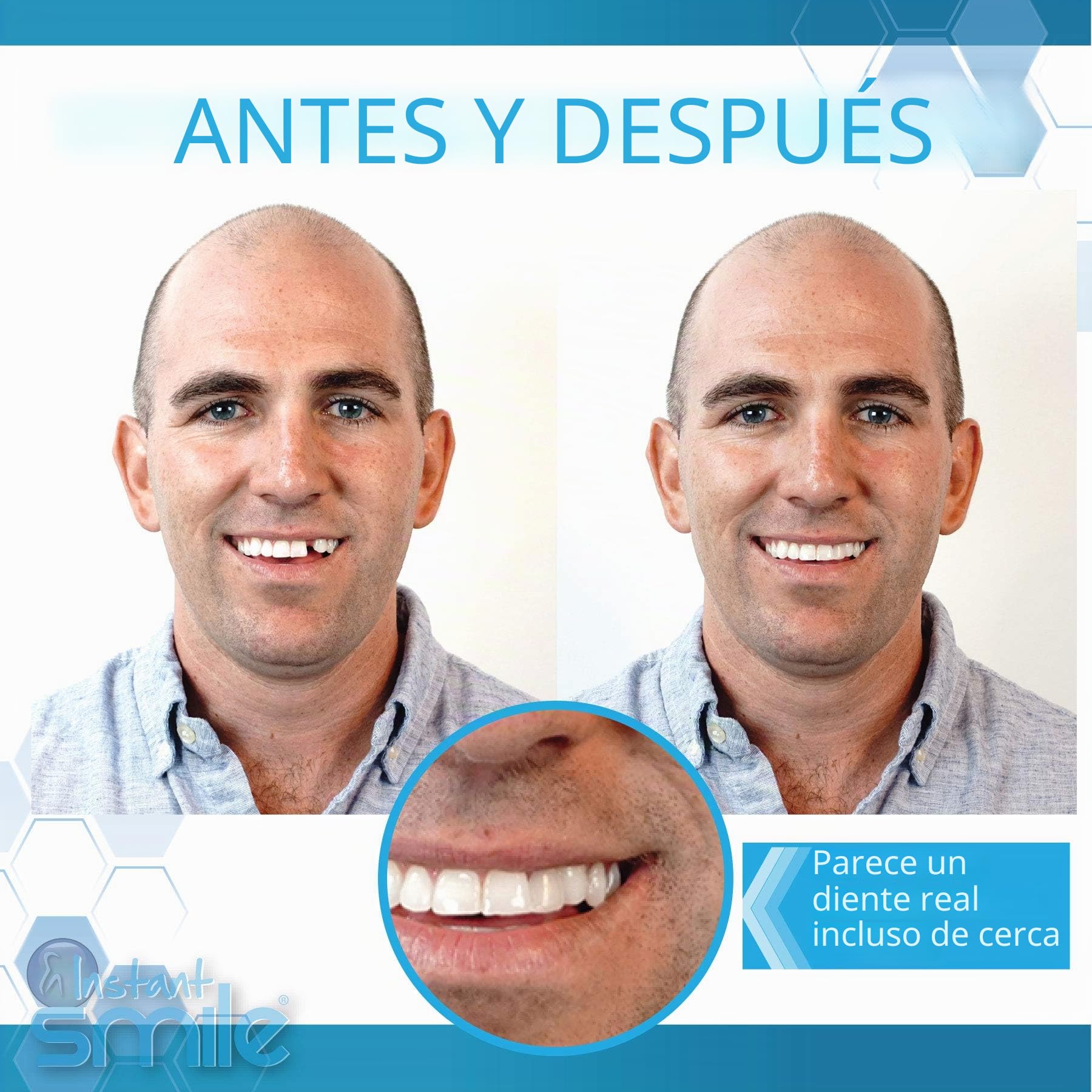 Instant Smile Completa Tu Sonrisa, Kit de Reemplazo Temporal de Dientes, Comfortable Fit, Natural Look Dentures, for Any Occasion