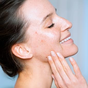 SVR - Sebiaclear Micro Peel - Sebiaclear Range - Renewing Exfoliant and Flawless Water - For Sensitive Acne Prone Skin - Niacinamide 4% PHA Zinc - 150ml