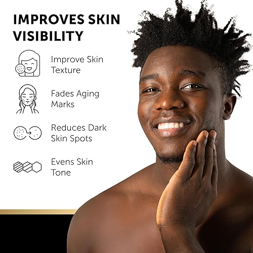 Miniatura 4 de VALITIC Paquete de 4 barras de jabón corrector de manchas oscuras de ácido kójico con vitamina C, retinol, colágeno, cúrcuma, complejo japonés