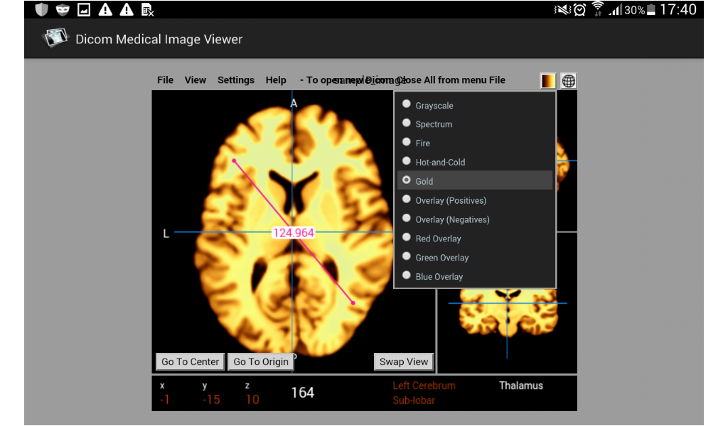 Dicom Medical Image Viewer-App im Amazon Appstore