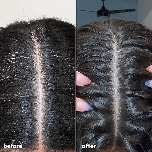 Miniatura 4 de Champú desintoxicante aclarante Coco and Eve. Elimina el agua dura y la acumulación de producto. Con vinagre de sidra de hibisco para desintoxicar