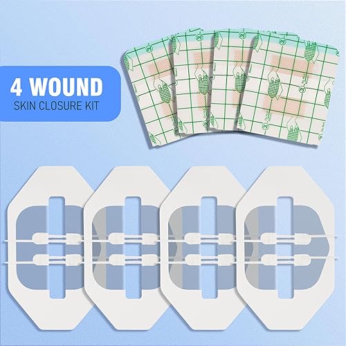 Miniatura 2 de AUSLKA Tiras de cierre de heridas Paquete de 4 Bandaids de mariposa Kit de cierre de laceración de puntada con cremallera para emergencias