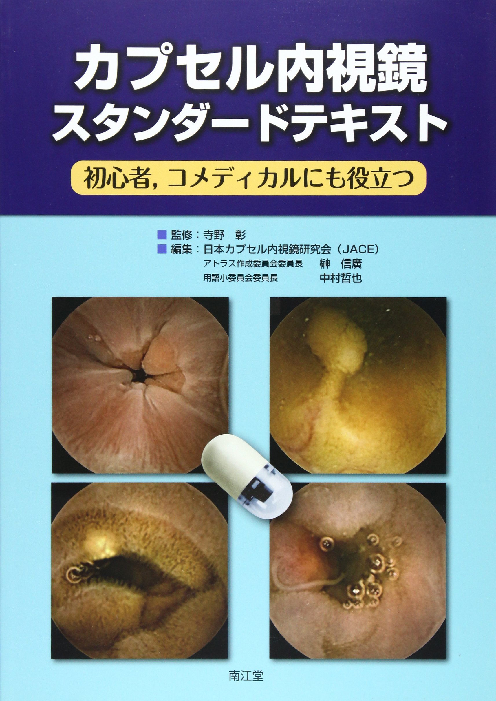【中古】カプセル内視鏡カラーアトラス?小腸病変の精細視野を拓く 81Fu-SpyJ9L.jpg