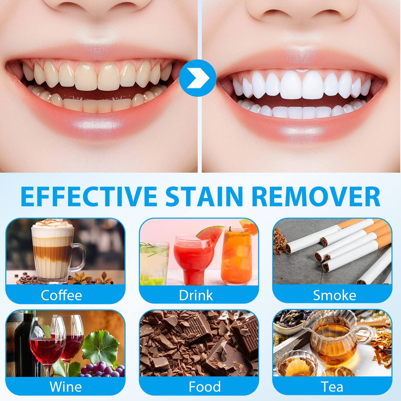 Kit Blanchiment Dentaire, Blanchiment Dent, gels de blanchiment des dents, Portable & Facile à Utiliser, Soins Dentaires à Domicile