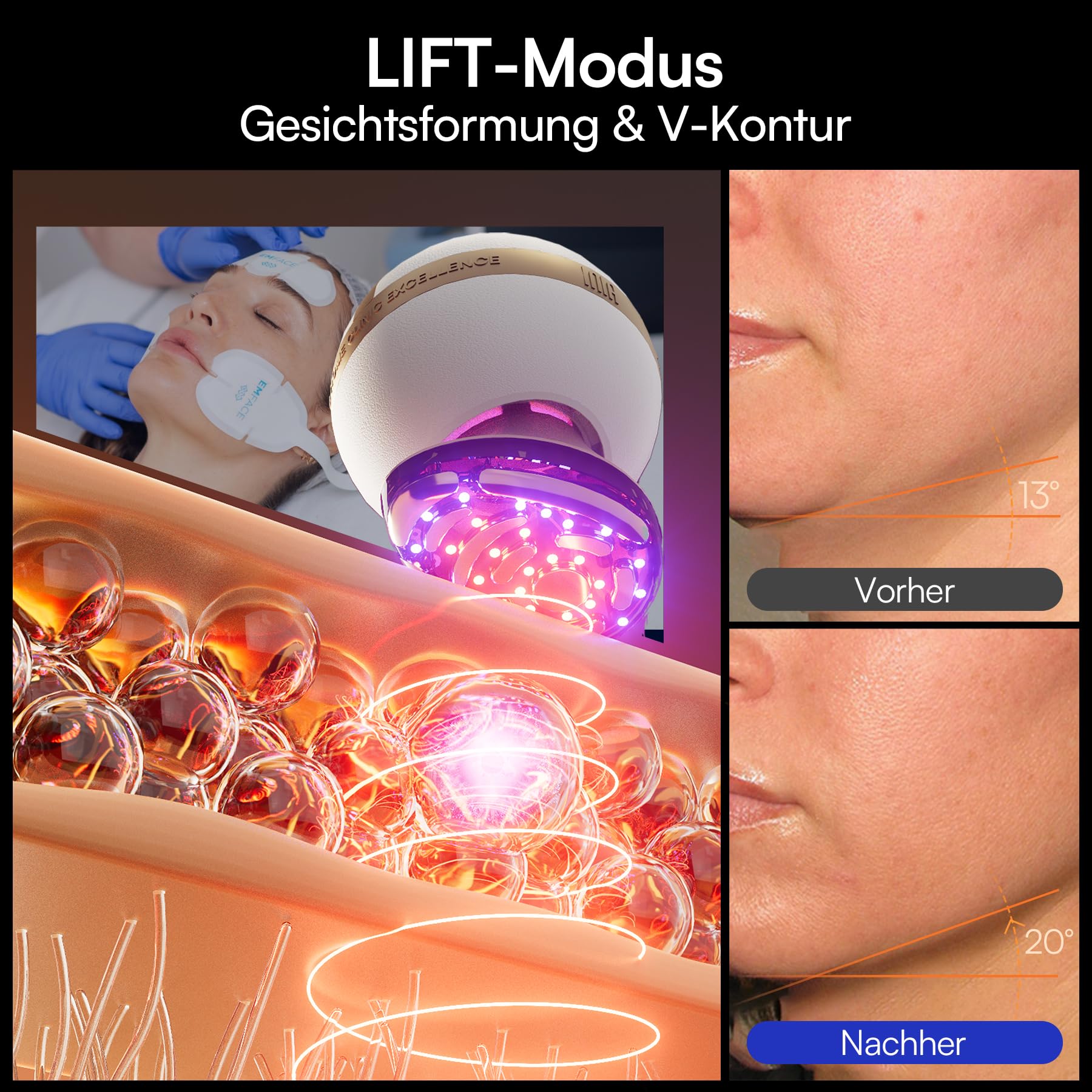 INIA SPHERA Verbesserter 8-in-1 Mikrostrom-Gesichtsmassager für Gesicht & Hals – Rotlicht, Wärme- & Kühlfunktion, 5 Modi, Beauty-Tool für definierte und strahlende Haut zu Hause