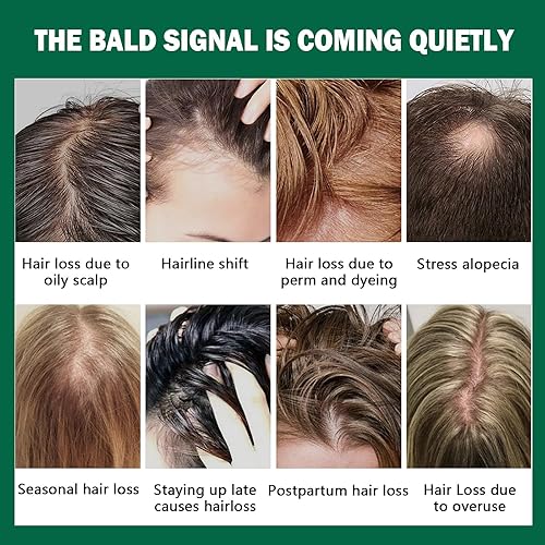 Miniatura 7 de Aceite de batana para el crecimiento del cabello, 100% natural crudo de Honduras, aceite de crecimiento del cabello para cabello más grueso y largo,