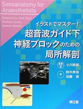 神経ブロックに必要な画像解剖 Amazon.co.jp: 神経ブロックに必要な画像解剖 (痛みのScience