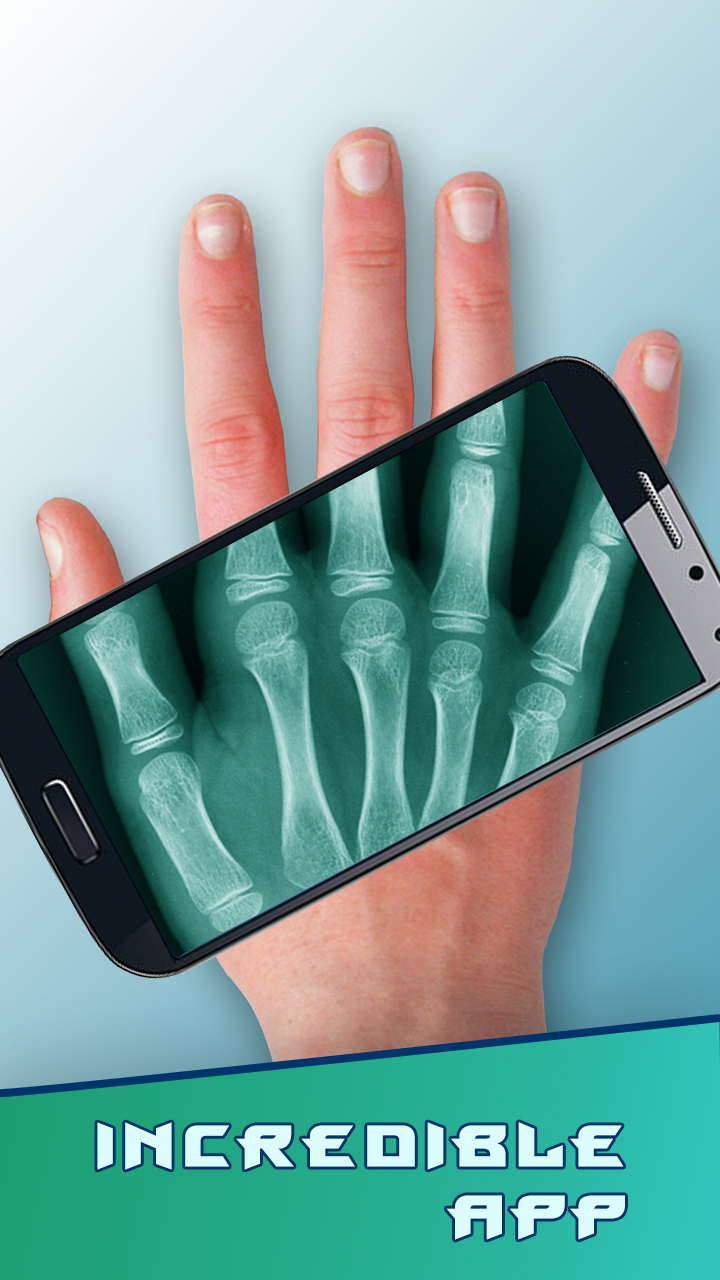 Amazing XRay App on the Amazon Appstore