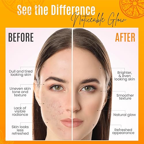 Miniatura 16 de Suero 30% orgánico de vitamina C para la cara, suero antiarrugas natural con ácido hialurónico y vitamina E, hidratante antienvejecimiento