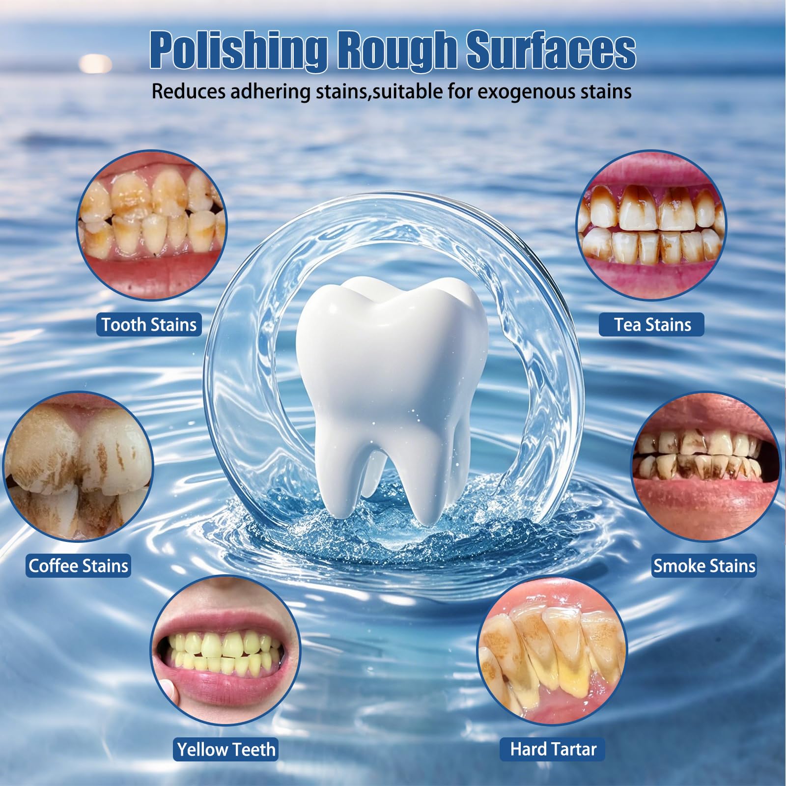 Pulidora Dental, Kit Recargable de Limpieza y Blanqueamiento Dental, Pulidora Dental Eléctrica con 3 Pastas de Pulido, 5 Cabezales, 5 Modos de Velocidad, Luz LED