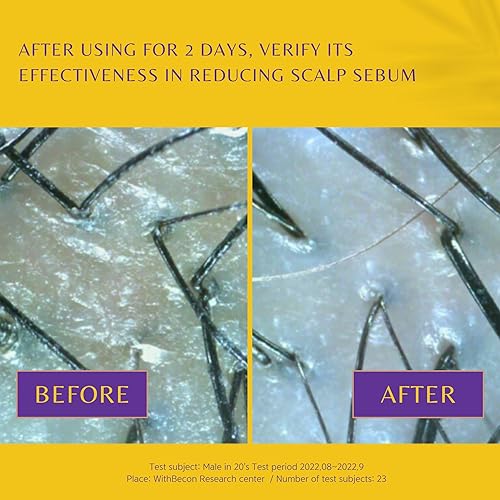 Miniatura 3 de WithBecon NoMoreOil Shampoo - Champú profesional para pérdida de cabello para cuero cabelludo graso, libre de crueldad animal y sin sulfatos (12.17