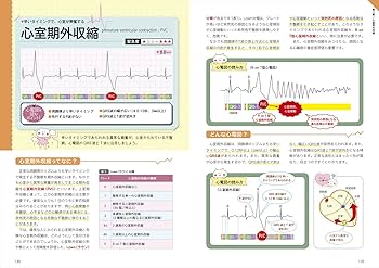 これならわかる! 心電図の読み方 ~モニターから12誘導まで