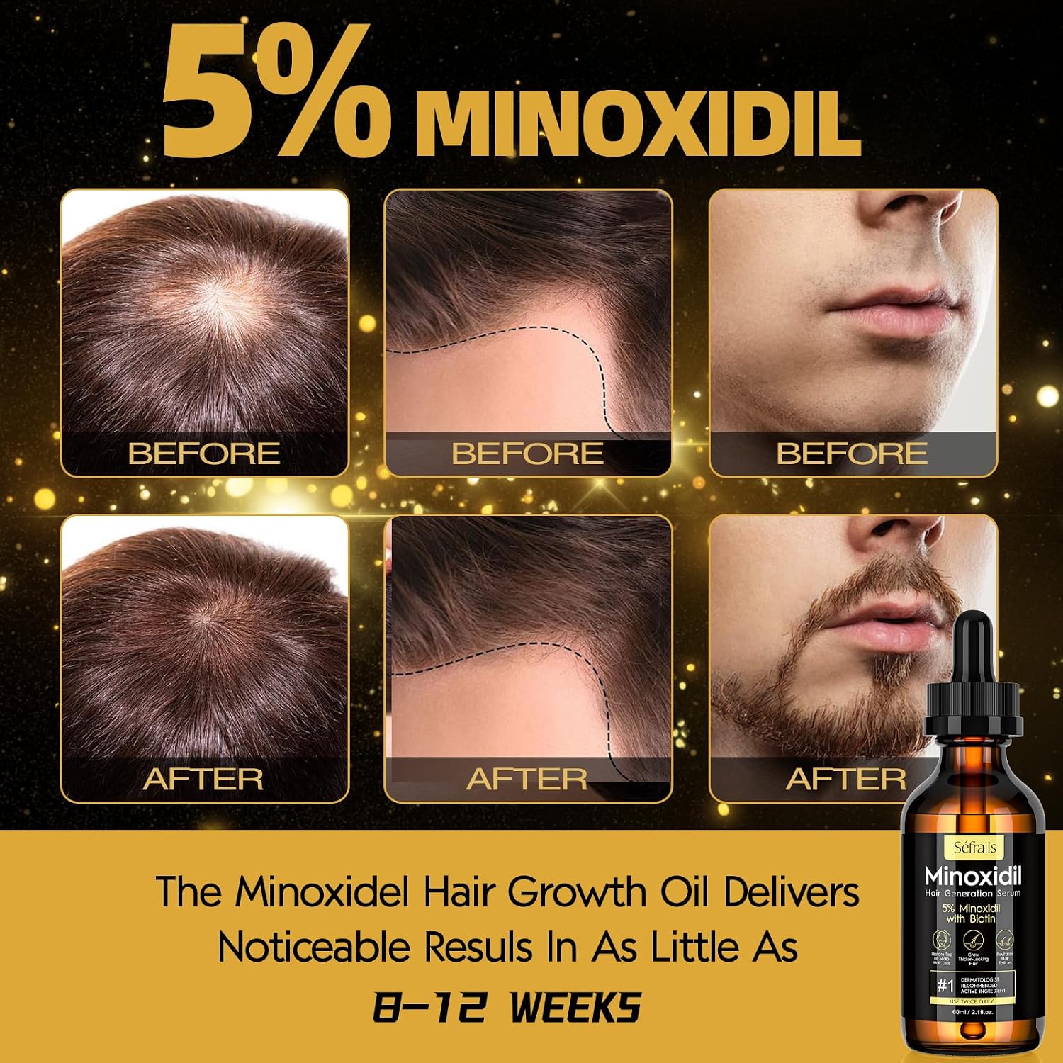 Sefralls 5% Minoxidil Hair Growth Oil for Men & Women - Extra Strength Regrowth Serum, Topical Hair Loss Treatment Serum, Thicker, Healthier Hair & Beard Growth, 2.11 oz