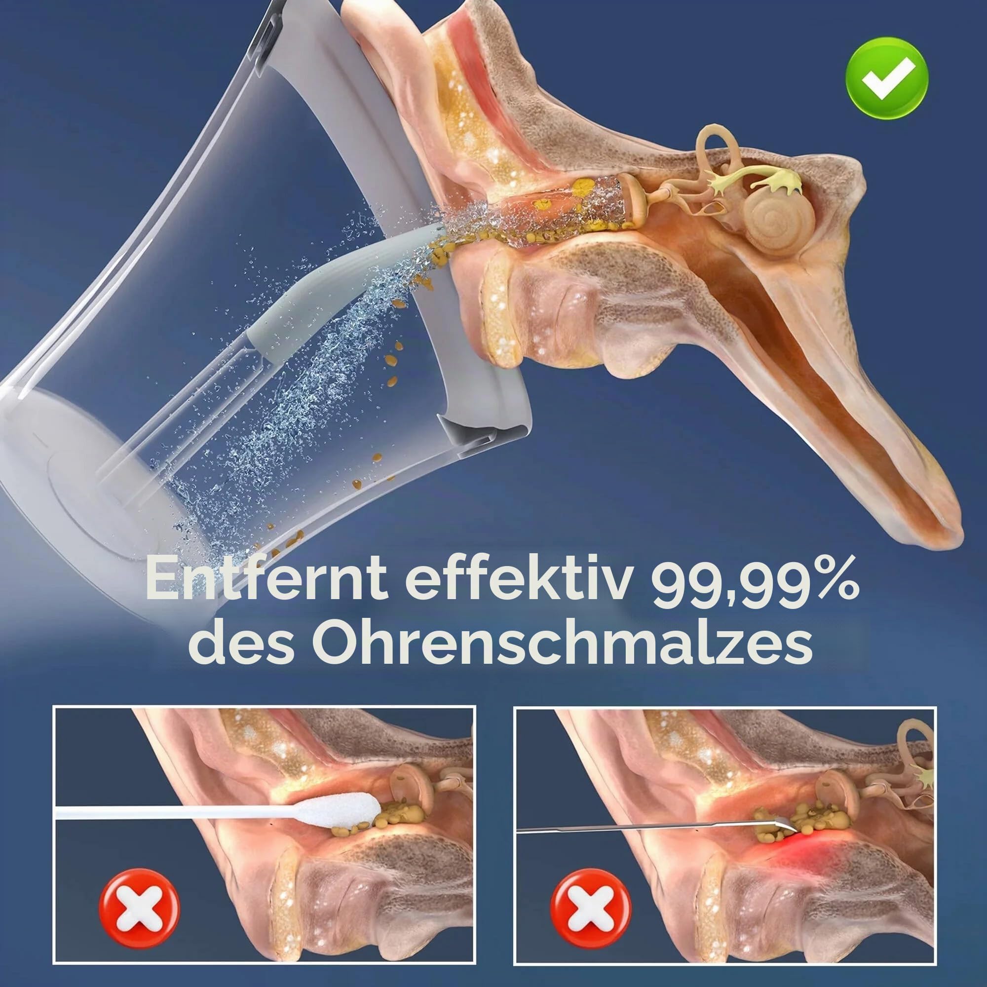 Morfone Ohrenschmalz Entferner(Grau)