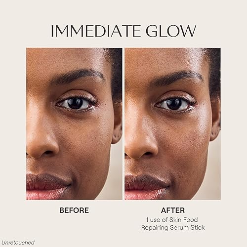 Miniatura 4 de Weleda Serum Reparador de Alimentos para la Piel