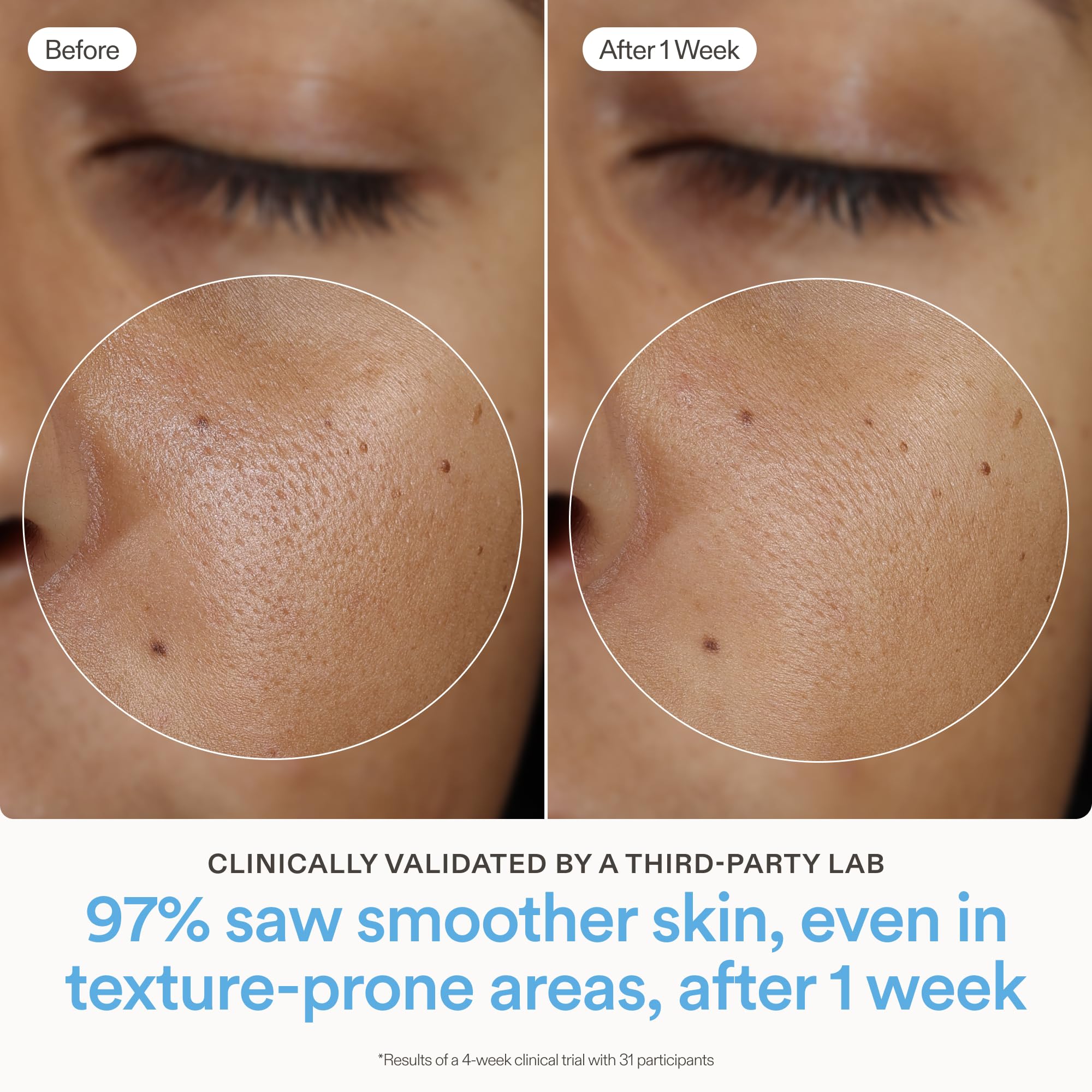 Skinfix Ceramide Prime Whipped Cream Facial Moisturizer with Niacinamide + Peptides