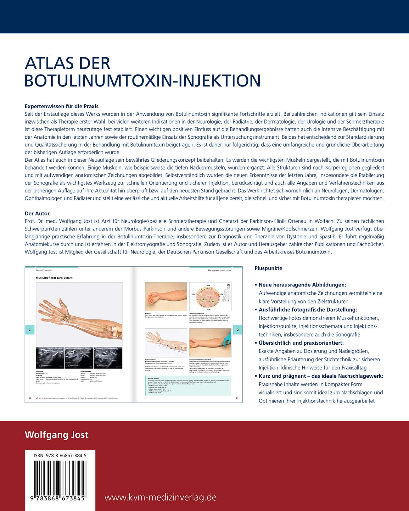 Atlas der Botulinumtoxin-Injektion: Dosierung | Lokalisation | Anwendung