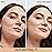 IT Cosmetics Bye Bye Dark Spots Concealer + Brightening Serum - 2% Niacinamide, Hyaluronic Acid & Caffeine - Medium Coverage, Natural Finish, All Skin Types - 11 Fair Neutral, 0.22 fl. oz