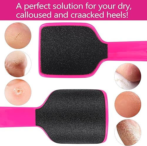 Miniatura 5 de 2 unidades de lima curvada para pies, removedor de callos en forma de U, rascador de archivos de talón de doble cara, removedor de piel muerta