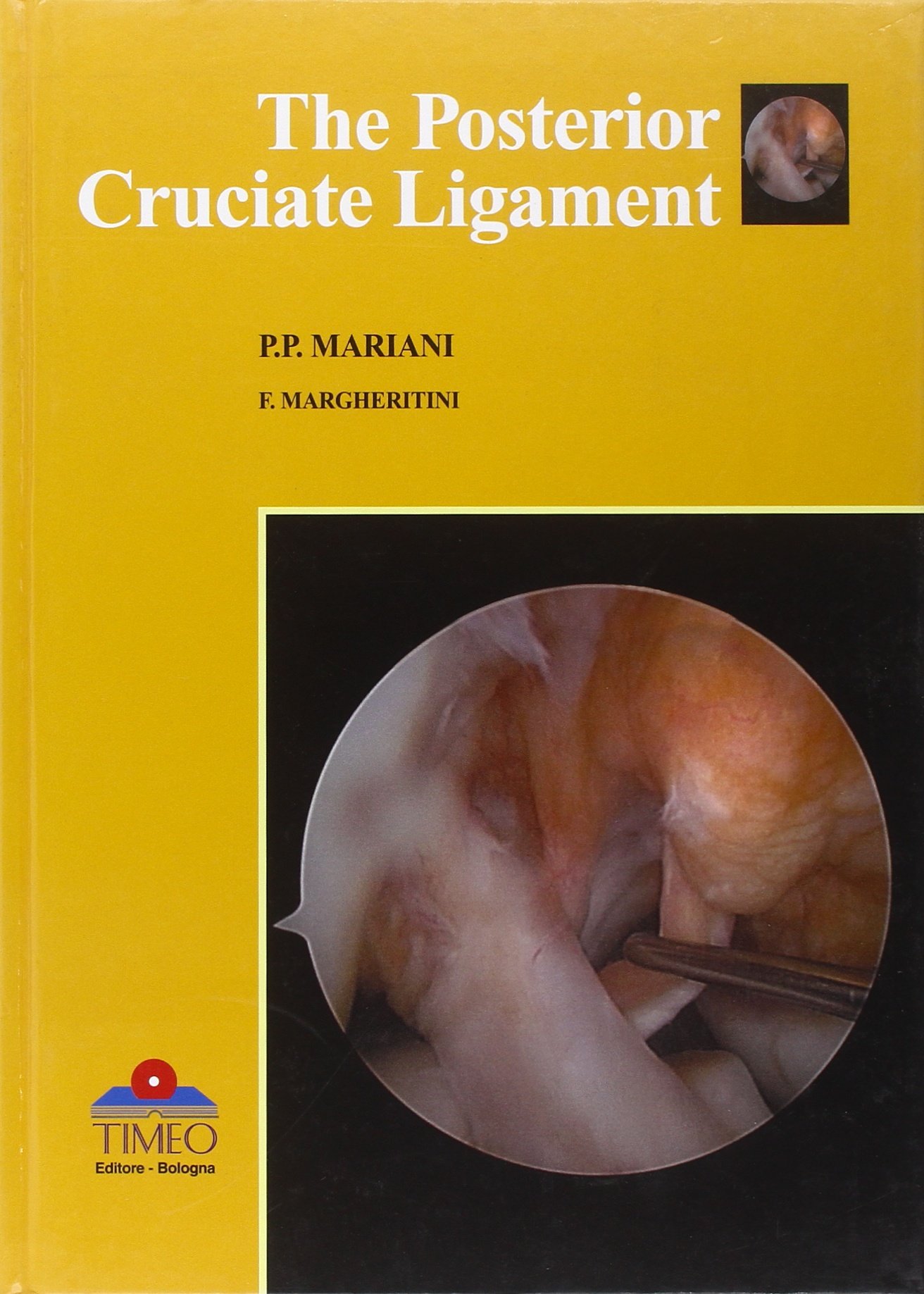 Posterior Cruciate Ligament