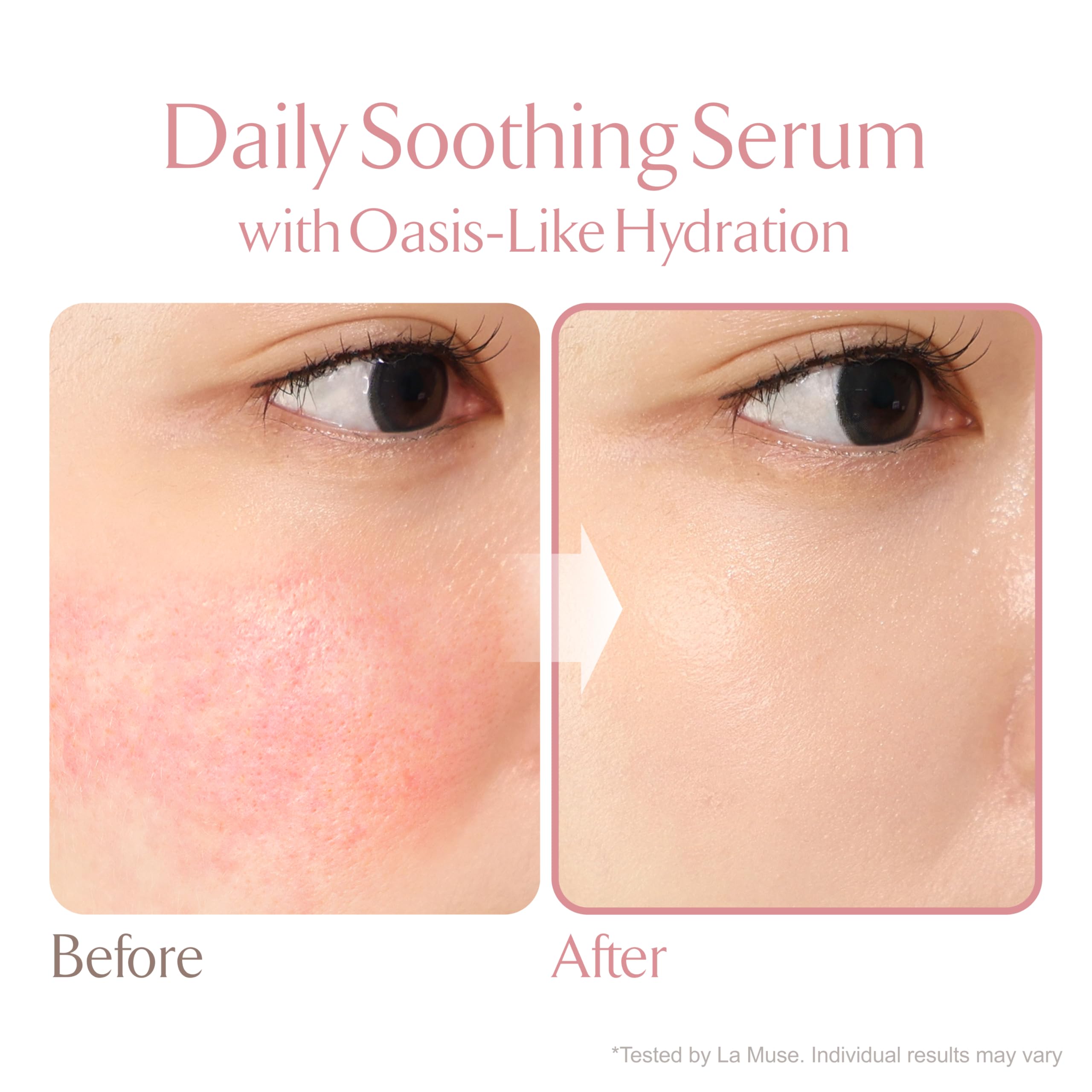 Amazon.com: LA MUSE Oasis Soothing Serum(Pouch / 2.71 fl oz) | Gel