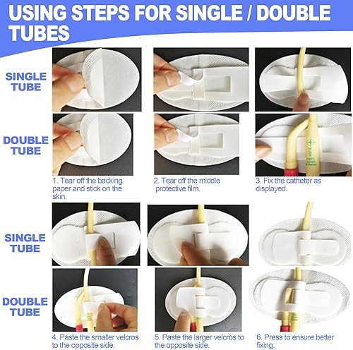 Miniatura 6 de Foley - Dispositivo de estabilización de catéter (paquete de 5)  Sujeta el tubo individualdoble, el tubo G y el tubo de alimentación en su lugar,