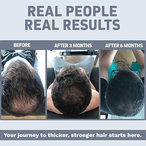 Miniatura 2 de Herbtonics Foli Tonic - Crecimiento del cabello con biotina, vitaminas para el cabello con bloqueador de DHT, Saw Palmetto, beta sitosterol,