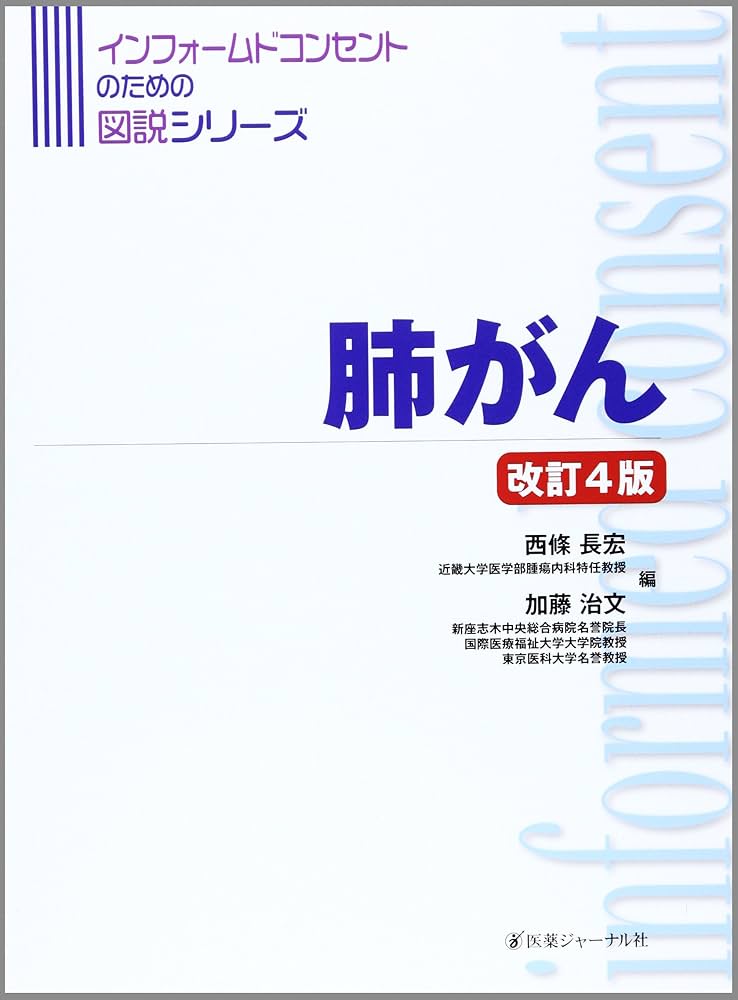 肺がん 改訂5版 (インフォームドコンセントのための図説シリーズ) 肺がん 改訂4版 (インフォームドコンセントのための図説シリーズ