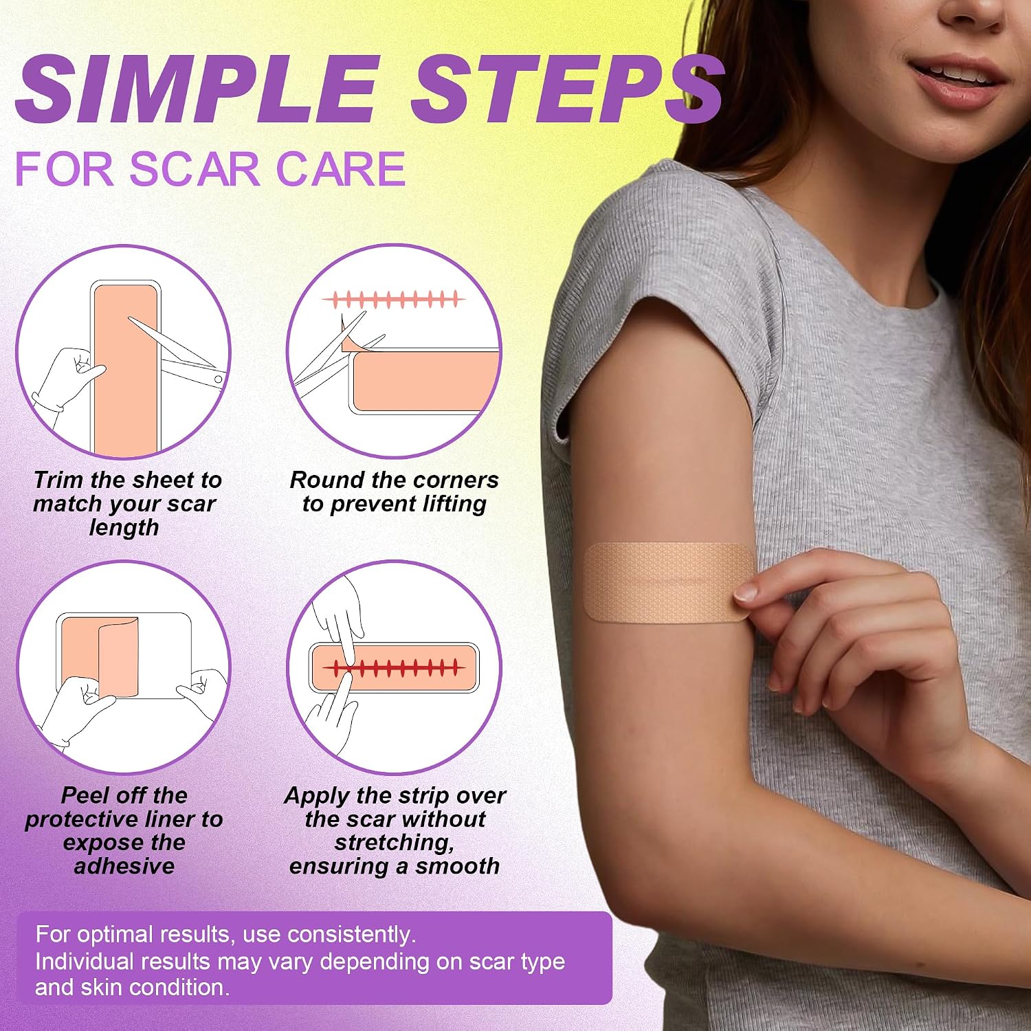 FRESINIDER Silicone Scar Sheets Roll - 1.6" X 120" (3 Meters) Silicone Scar Tape for Surgical C-Section Tummy Tuck, Keloid Burn Acne - Extra Long & Reusable Professional Scar Removal Strips