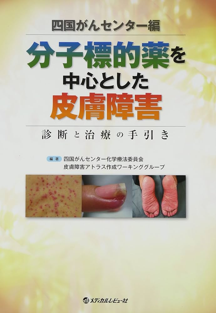Amazon.co.jp: 分子標的薬を中心とした皮膚障害: 診断と治療の