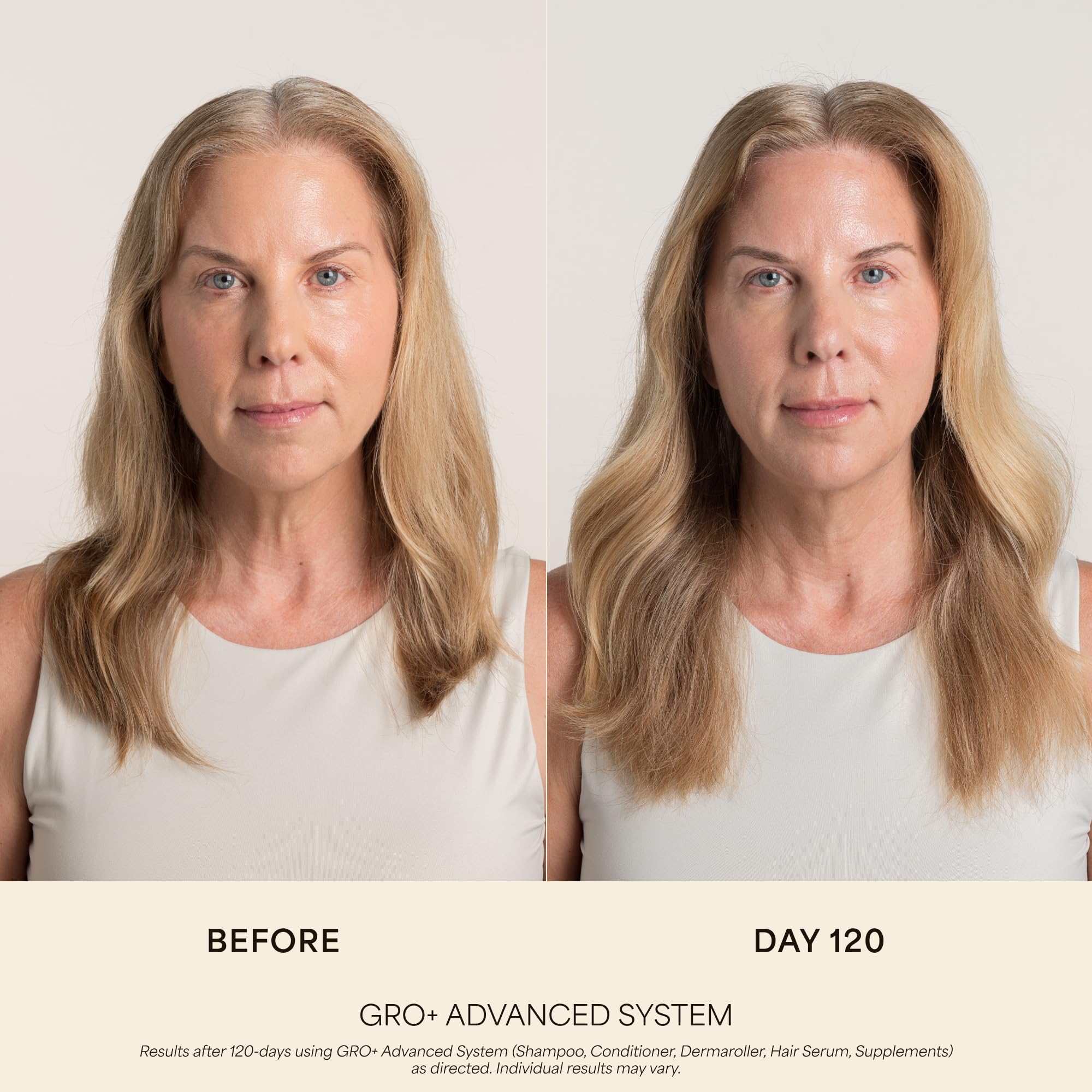 VEGAMOUR GRO+ Advanced Balancing Conditioner, hidrata el cuero cabelludo, nutre y suaviza el cabello, para pieles pesadas
