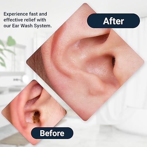 Miniatura 6 de Doctor Easy, Wax-Rx, Sistema de Lavado de Oído con Ph, 15.2 onzas