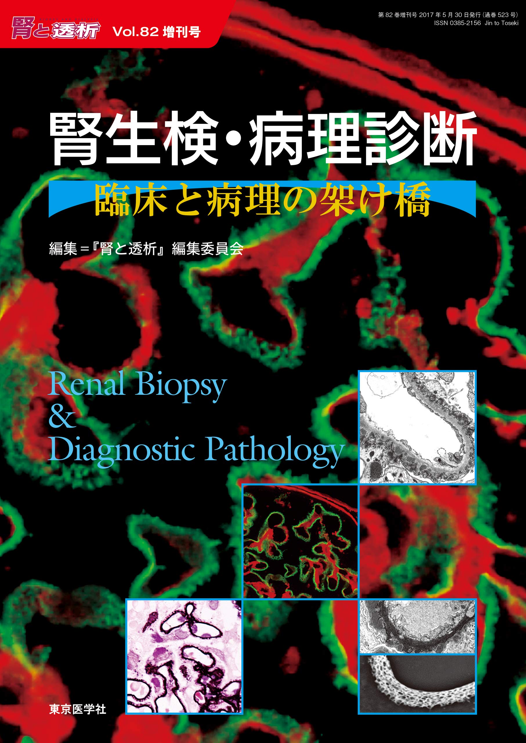 腎と透析2017年82巻増刊号 腎生検・病理診断―臨床と病理の架け橋 腎と透析2017年82巻増刊号 腎生検・病理診断―臨床と病理の架け橋