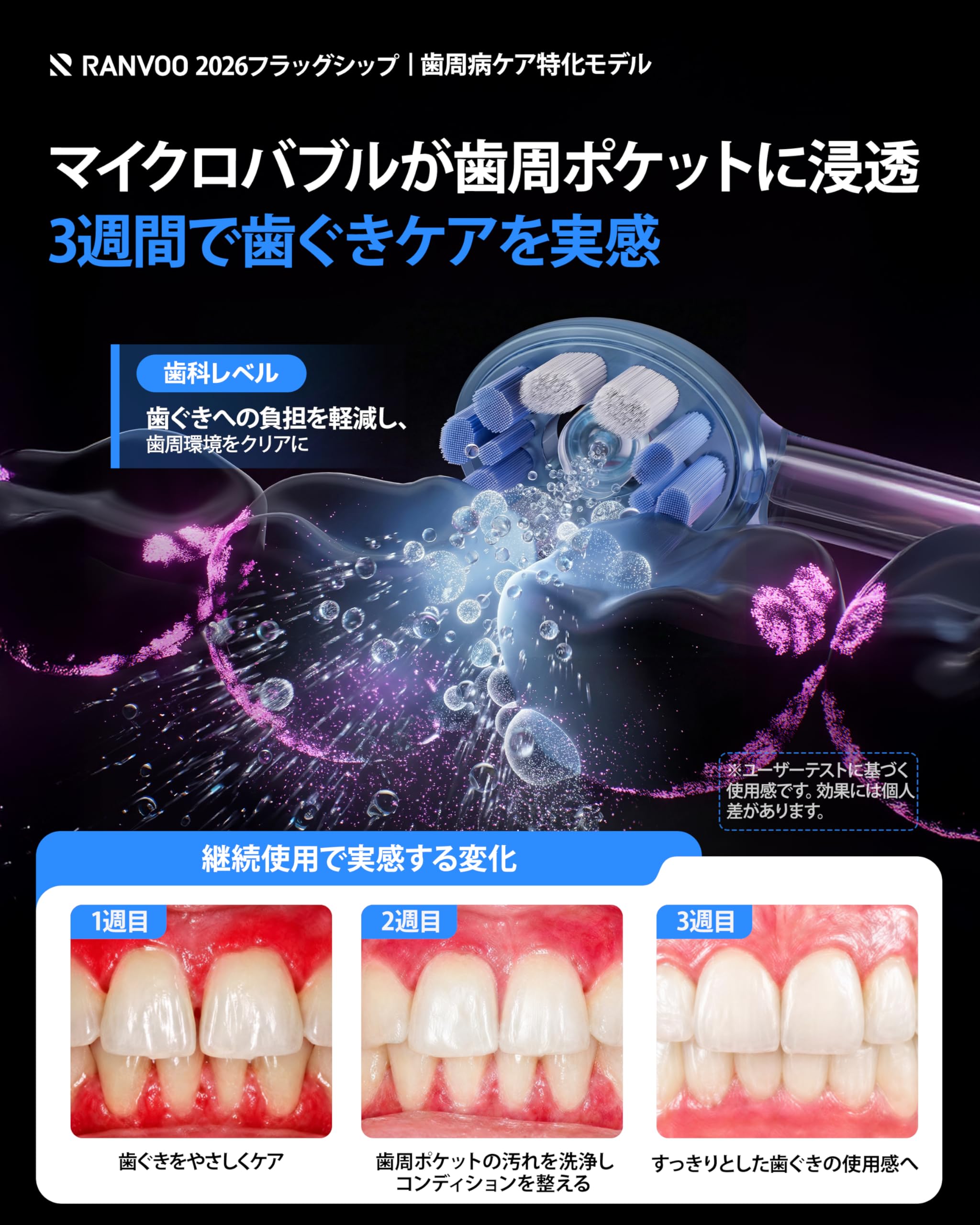 Amazon.co.jp: 【歯周ケア特化 次世代バブルジェット洗浄】RANVOO