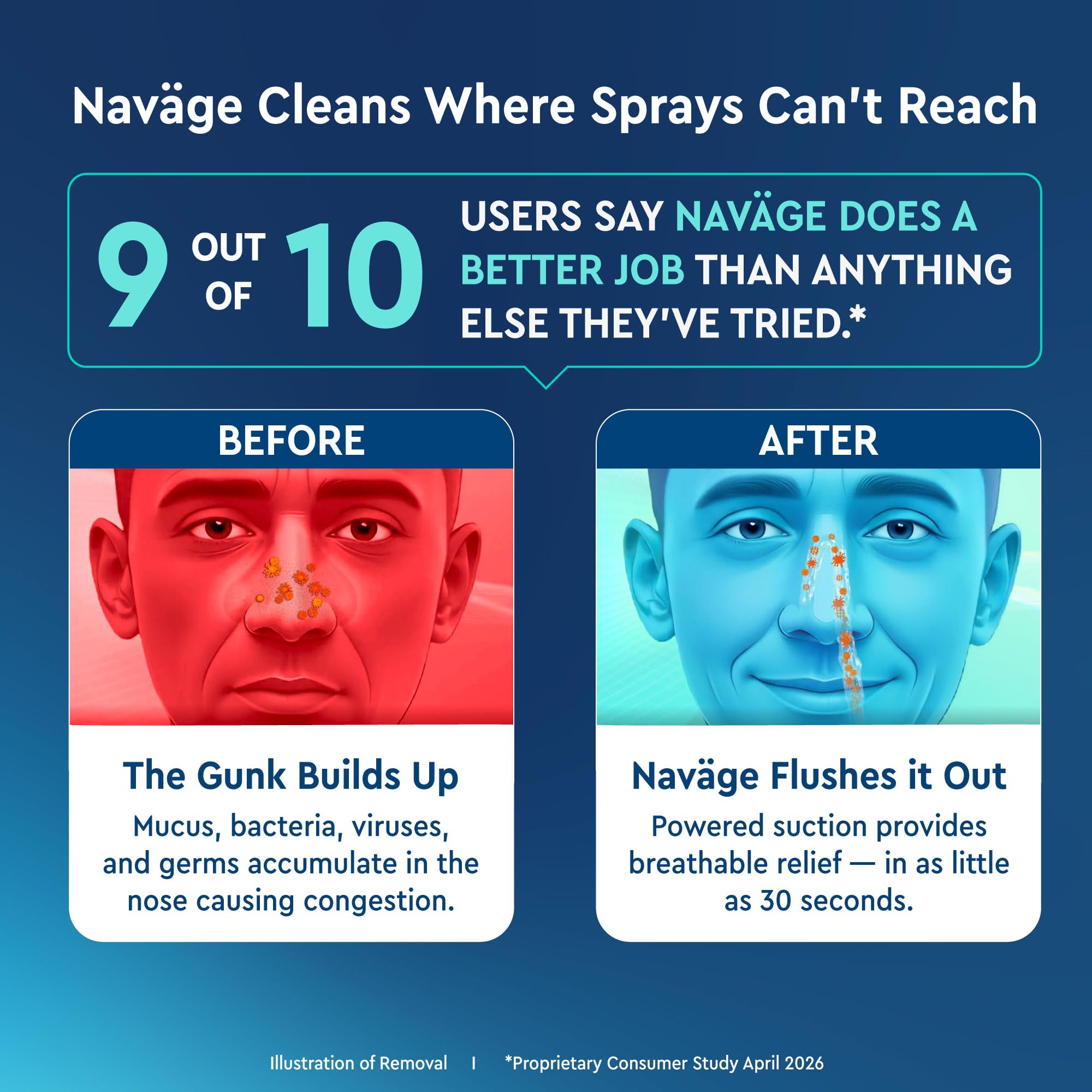 NAVAGE® Premium Bundle Nose Cleaner, 90 SaltPods, Caddy, Extra Dock — Amazon image 3