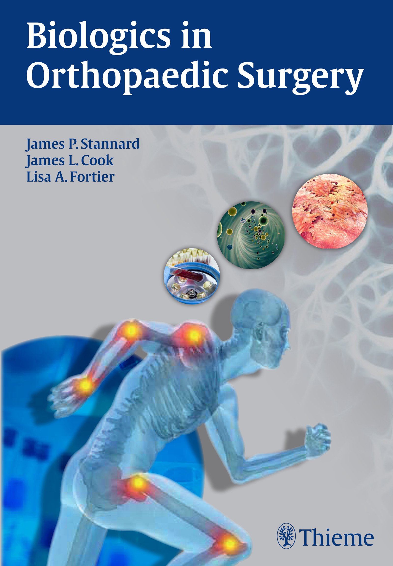 Buy Biologics in Orthopaedic Surgery — BookShops.in